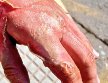 Por qué nunca se debe echar agua sobre aceite ardiendo