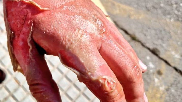 Por qué nunca se debe echar agua sobre aceite ardiendo